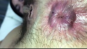 Risika Farting Thong and Hairy Asshole